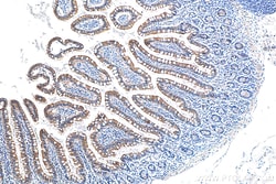 SLC6A19 Rabbit Polyclonal Antibody, Proteintech Unconjugated; 150 &mu;L:Antibodies,