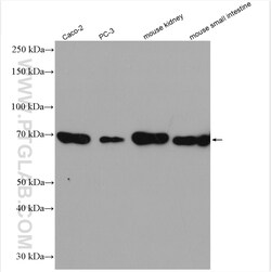 SLC6A19 Rabbit Polyclonal Antibody, Proteintech Unconjugated; 150 &mu;L:Antibodies,