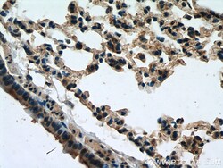 Serotonin transporter Rabbit Polyclonal Antibody, Proteintech:Antibodies:Primary