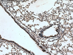 Serotonin transporter Rabbit Polyclonal Antibody, Proteintech:Antibodies:Primary