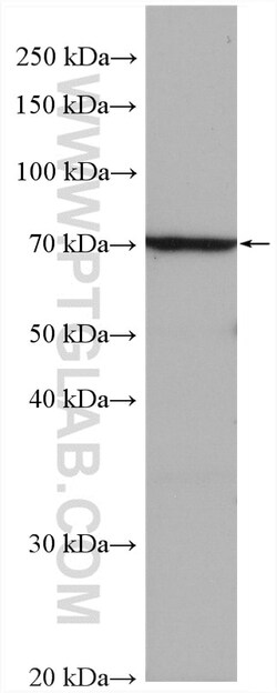 Serotonin transporter Rabbit Polyclonal Antibody, Proteintech:Antibodies:Primary