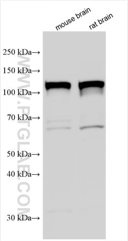 Serotonin transporter Rabbit Polyclonal Antibody, Proteintech:Antibodies:Primary