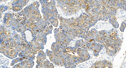 SLC7A2 Rabbit Polyclonal Antibody, Proteintech Unconjugated; 150 &mu;L:Antikörper