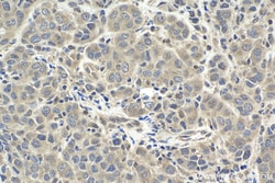 SMURF2 Rabbit Polyclonal Antibody, Proteintech Unconjugated; 20 &mu;L:Antibodies,