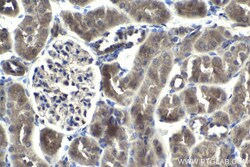 SMURF2 Rabbit Polyclonal Antibody, Proteintech Unconjugated; 20 &mu;L:Antibodies,