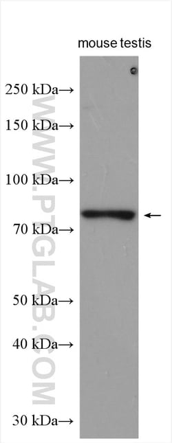 SMURF2 Rabbit Polyclonal Antibody, Proteintech Unconjugated; 20 &mu;L:Antibodies,