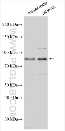 SMURF2 Rabbit Polyclonal Antibody, Proteintech Unconjugated; 20 &mu;L:Antibodies,