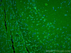 SNCB Mouse Monoclonal Antibody, Proteintech Unconjugated; 20 &mu;L:Antibodies,