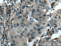 SNF8 Mouse Monoclonal Antibody, Proteintech:Antibodies:Primary Antibodies