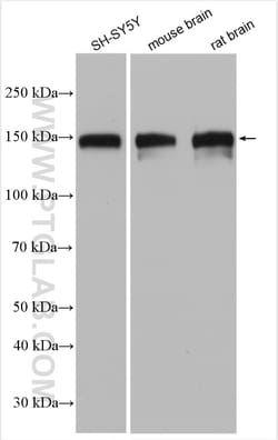 SNIP/p140Cap Rabbit Polyclonal Antibody, Proteintech:Antibodies:Primary