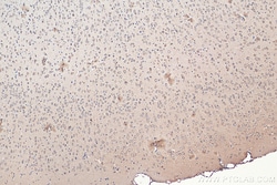 SNN Rabbit Polyclonal Antibody, Proteintech Unconjugated; 20 &mu;L:Antibodies