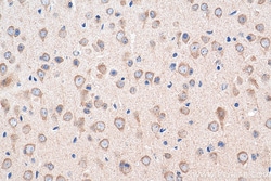 SNN Rabbit Polyclonal Antibody, Proteintech Unconjugated; 20 &mu;L:Antibodies