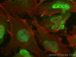 CoraLite Plus 488-conjugated SNRPN Mouse Monoclonal Antibody, Proteintech 100 &mu;L | Buy Online | Proteintech | Fisher Scientific