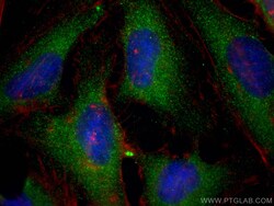 SNX12 Mouse Monoclonal Antibody, Proteintech Unconjugated; 20 &mu;L:Antibodies,
