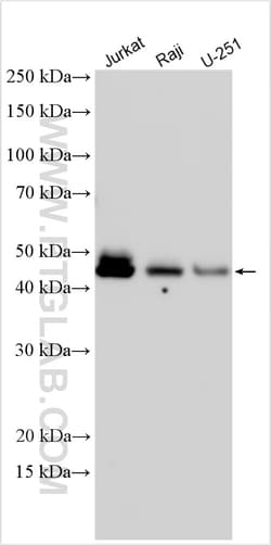 SNX16 Rabbit Polyclonal Antibody, Proteintech Unconjugated; 150 &mu;L:Antibodies,