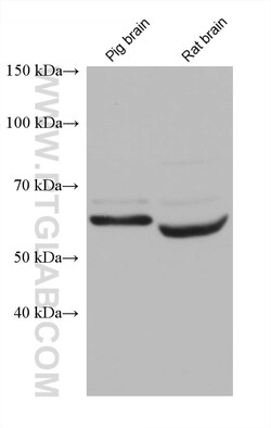 SNX17 Mouse Monoclonal Antibody, Proteintech Unconjugated; 150 &mu;L:Antibodies,
