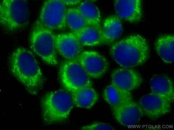 SNX3 Mouse Monoclonal Antibody, Proteintech:Antibodies:Primary Antibodies