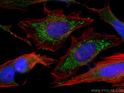 SNX5 Mouse Monoclonal Antibody, Proteintech:Antibodies:Primary Antibodies