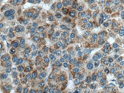 SNX5 Mouse Monoclonal Antibody, Proteintech:Antibodies:Primary Antibodies