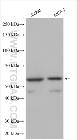 SNX8 Rabbit Polyclonal Antibody, Proteintech:Antibodies:Primary Antibodies