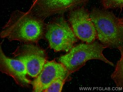SNX9 Mouse Monoclonal Antibody, Proteintech:Antibodies:Primary Antibodies