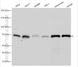 SOAT1/ACAT1 Rabbit Polyclonal Antibody, Proteintech:Antibodies:Primary