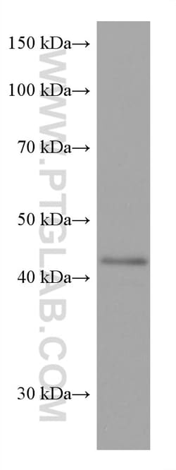 SOX1 Mouse Monoclonal Antibody, Proteintech:Antibodies:Primary Antibodies