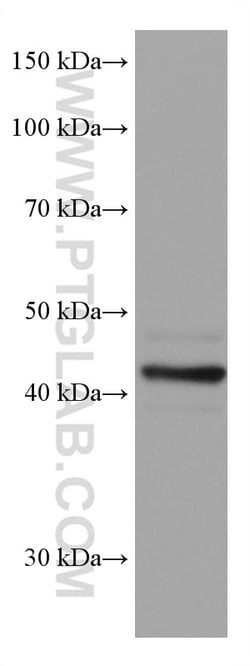 SOX1 Mouse Monoclonal Antibody, Proteintech:Antibodies:Primary Antibodies