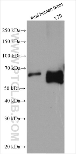 SOX11 Rabbit Polyclonal Antibody, Proteintech