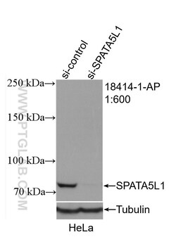 SPATA5L1 Rabbit Polyclonal Antibody, Proteintech:Antibodies:Primary Antibodies