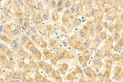 SPG7 Rabbit Polyclonal Antibody, Proteintech Unconjugated; 150 &mu;L:Antibodies,