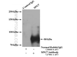 SPG7 Rabbit Polyclonal Antibody, Proteintech Unconjugated; 150 &mu;L:Antibodies,