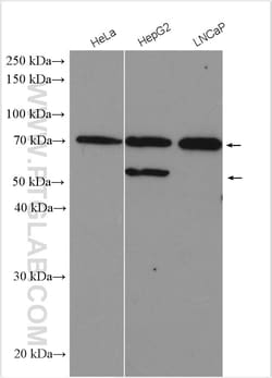 SPG7 Rabbit Polyclonal Antibody, Proteintech Unconjugated; 150 &mu;L:Antibodies,