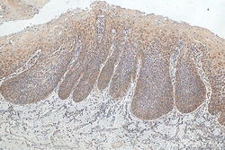 SPINK7 Rabbit Polyclonal Antibody, Proteintech:Antistoffer:Primære antistoffer