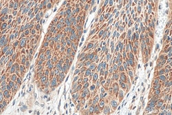 SPINK7 Rabbit Polyclonal Antibody, Proteintech