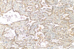 SPIRE1 Rabbit Polyclonal Antibody, Proteintech:Antibodies:Primary Antibodies