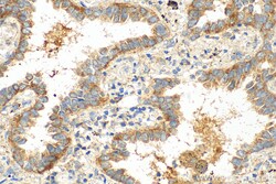 SPIRE1 Rabbit Polyclonal Antibody, Proteintech:Antibodies:Primary Antibodies