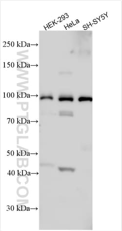 SPIRE1 Rabbit Polyclonal Antibody, Proteintech:Antibodies:Primary Antibodies