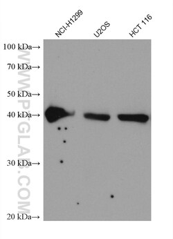 SPOP Mouse Monoclonal Antibody, Proteintech Unconjugated; 20 &mu;L:Antibodies,