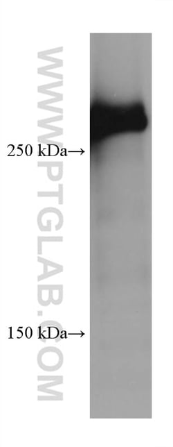 SPTBN1 Mouse Monoclonal Antibody, Proteintech Unconjugated; 20 &mu;L:Antibodies,