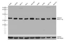 SSSCA1 Mouse Monoclonal Antibody, Proteintech Unconjugated; 150 &mu;L:Antibodies,