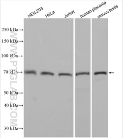 ST3GAL5 Rabbit Polyclonal Antibody, Proteintech Unconjugated; 20 &mu;L:Anticuerpos