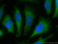 STIP1 Mouse Monoclonal Antibody, Proteintech 20 &mu;L | Buy Online | Proteintech | Fisher Scientific