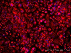 STK11/LKB1 Mouse Monoclonal Antibody, Proteintech Unconjugated; 150 &mu;L:Antibodies,