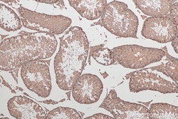 STK11/LKB1 Mouse Monoclonal Antibody, Proteintech Unconjugated; 150 &mu;L:Antibodies,