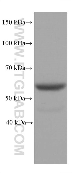 STK11/LKB1 Mouse Monoclonal Antibody, Proteintech Unconjugated; 150 &mu;L:Antibodies,
