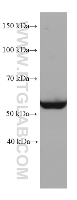 STK11/LKB1 Mouse Monoclonal Antibody, Proteintech Unconjugated; 150 &mu;L:Antibodies,