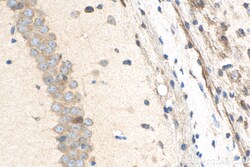 Biotin-conjugated STK25 Rabbit Polyclonal Antibody, Proteintech Biotin;