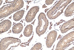 Biotin-conjugated STK25 Rabbit Polyclonal Antibody, Proteintech Biotin;