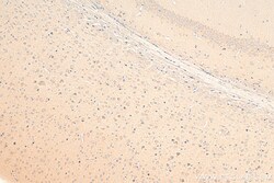 Biotin-conjugated STK25 Rabbit Polyclonal Antibody, Proteintech Biotin;